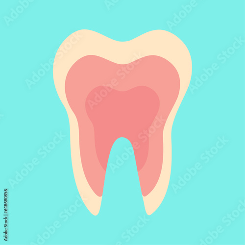 Inflamed tooth, inflamed pulp