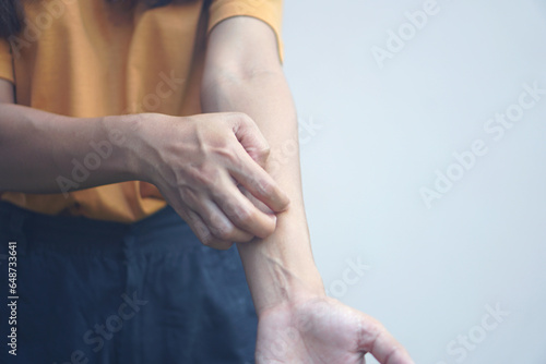Asian woman having itchy skin on arm..