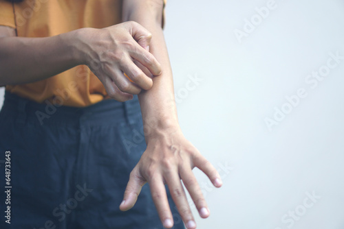 Asian woman having itchy skin on arm..