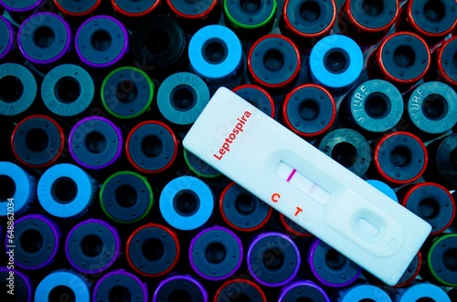 The patient positive tested for leptospira by rapid diagnostic test. photo