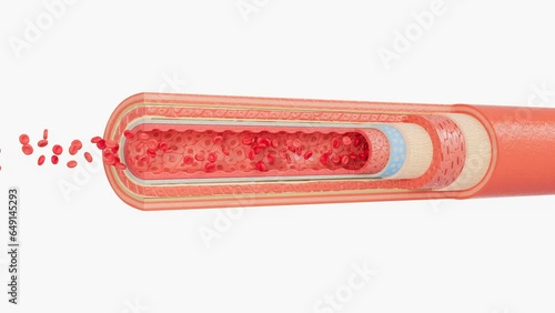 slice of Arter layers that Red and white blood cells flow inside that carry oxygen nutrien from heart to cells.
artery layers : outer layer,smooth muscle, elastic layer,inner layer photo