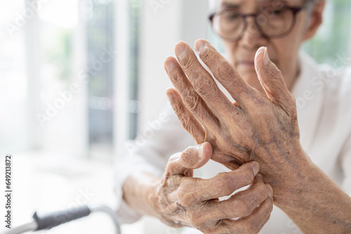 Old elderly scratch her hands,dry skin (Xerosis),Dermatitis problems,itchy skin on the back of hands,contact with irritants or allergens,allergies to certain soaps, detergents,itching and discomfort