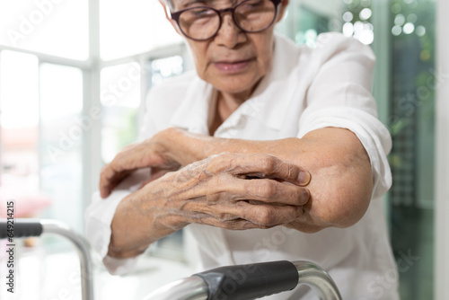 Old elderly scratching arm elbow itchy skin,skin irritation,atopic dermatitis or disorders of nerves and the nervous system,neurological diseases,itching sensations without a visible cause on the skin photo