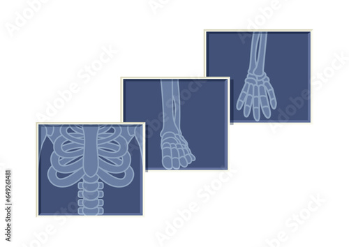 Chest, arm and foot skeleton bones X ray radiology vector flat design on white background