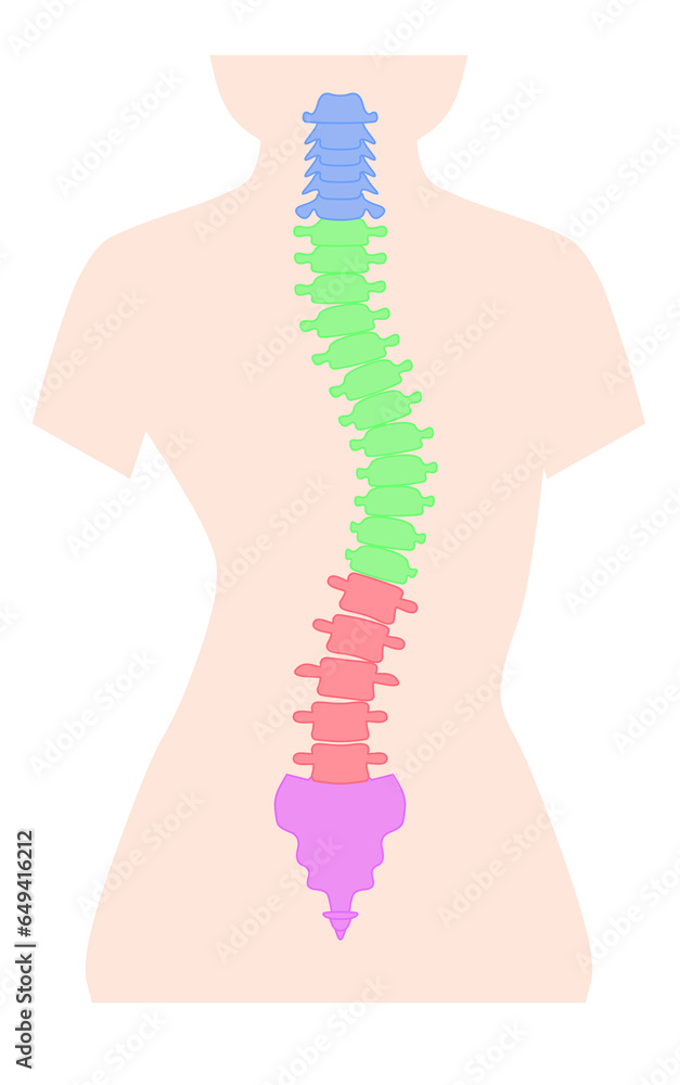 側湾症の背骨のシンプルなイラスト