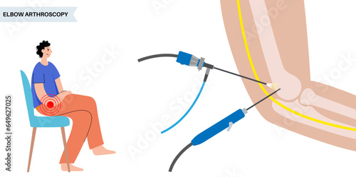 Elbow arthroscopy surgery