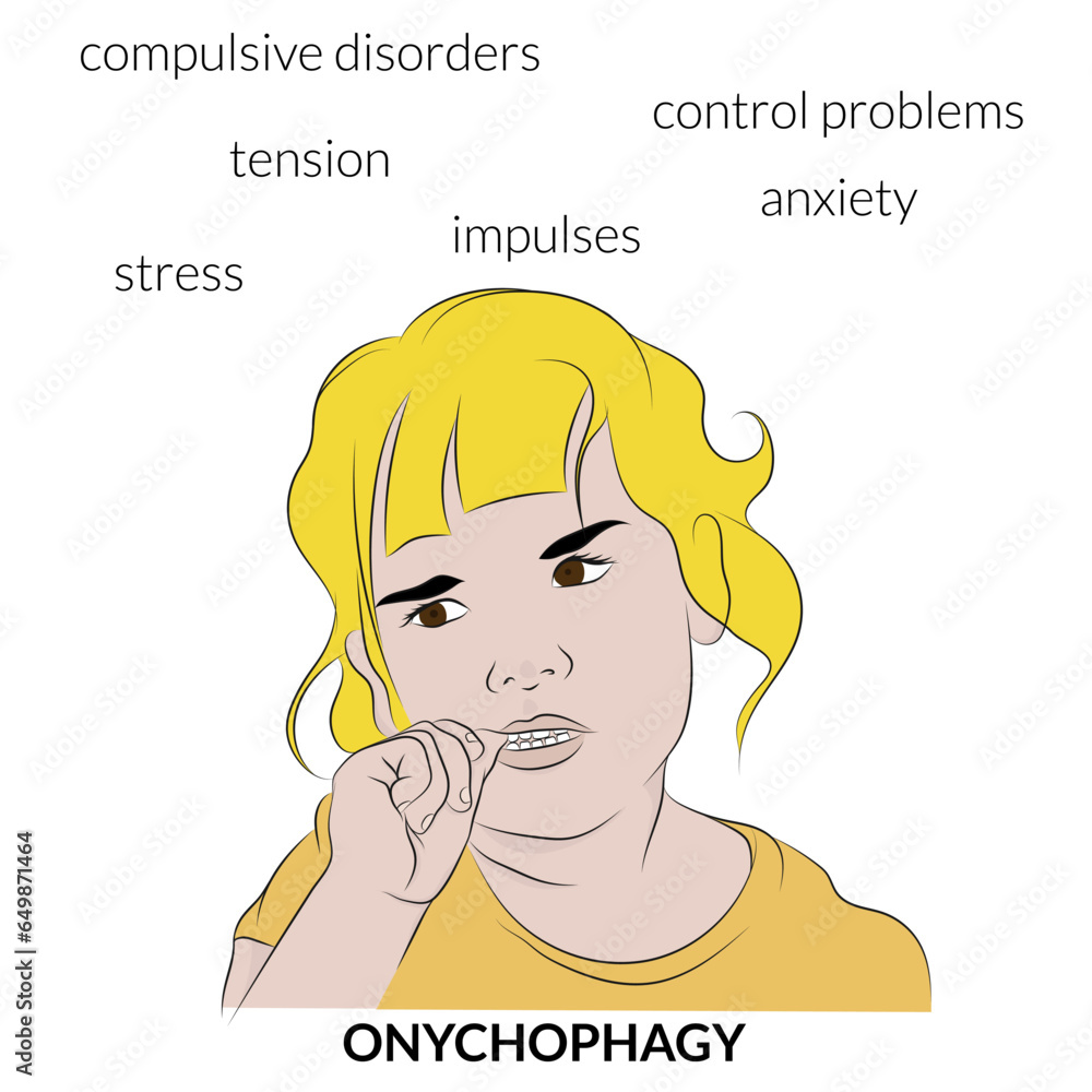 Onychophagy, the habit of biting nails with the teeth, causing damage