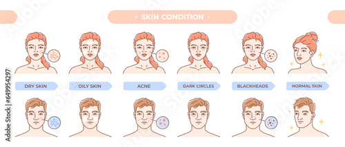 Skin condition set. Woman and man take care of beauty and health. Faces with acne and blackheads, dryness and dark circles. Cosmetology and dermatology. Linear flat vector isolated on white background