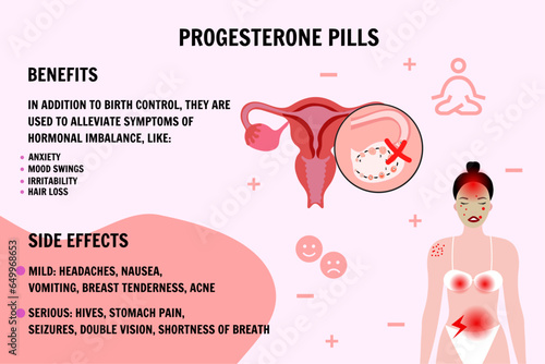 Progesterone pills medical information and illustration 