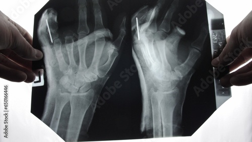 Wallpaper Mural Doctor Radiologist Examining X-Ray Image of Hands Wrists POV Torontodigital.ca