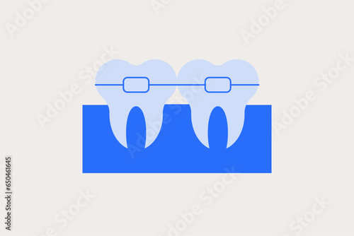 Geometric dental braces illustration in flat style design. Vector illustration. Duotone blue.