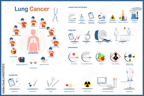 Medical infographic illustration concept of lung cancer,symptoms, causes and risk factors,diagnosis,prevention and treatment of lung cancer.Flat vector illustration.isolated on white background. photo