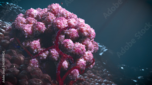 Small tumor cancer cells treatment cluster on the health tissue blood vessels side view oncology photo