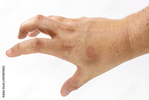 male hand, dry and with skin spots, dermatological problem, solar melanosis starting, skin without sunscreen, isolated on white background, photo