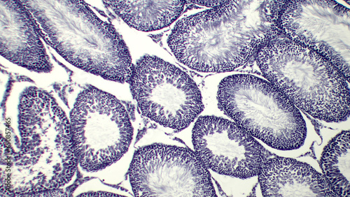 Microscopic Marvel: Histological Slice of Seminiferous Tubules photo
