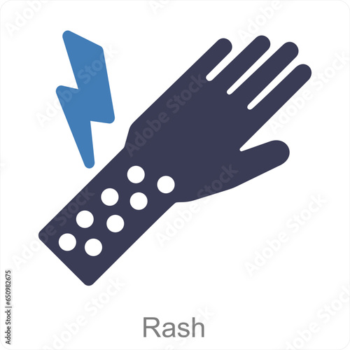 Rash