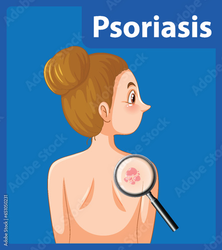 Omen with Psoriasis: A Cartoon Illustration of Skin Disease