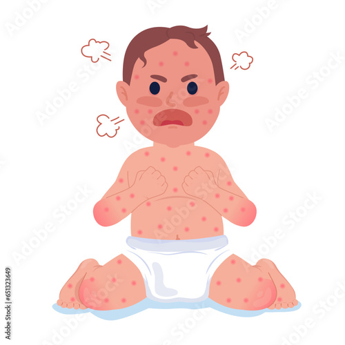 Crying baby with measles 2D cartoon character. Little child high fever isolated vector person white background. Chicken pox infant boy in diapers. Chickenpox symptom color flat spot illustration