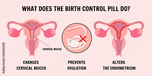 Birth control pills medical illustration