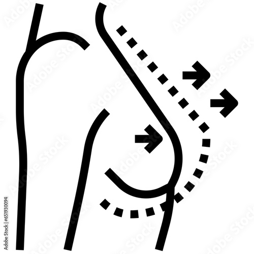 BREAST AUGMENTATION filled outline icon,linear,outline,graphic,illustration