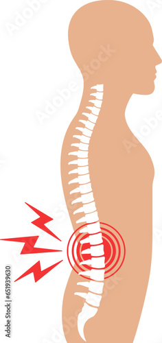 Illustration of back pain. Spine ache.