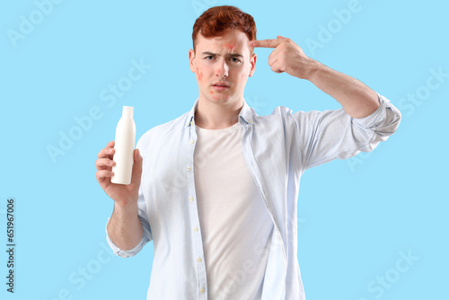 Teenage boy with remedy for...