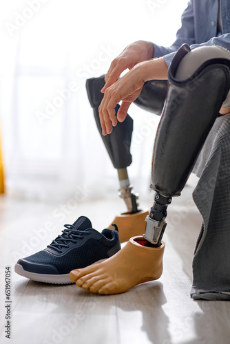 cropped man leg amputee wearing or changing prostheses at home sitting on bed in bright room, alone. handsome guy having strong spirit never give up. male with physical disability, in the morning © alfa27