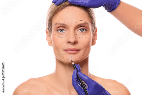 Doctor with pencil preparing patient for cosmetic surgery operation on white background, closeup photo