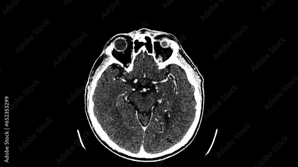 BRAIN MRI BRAIN MAGNETIC RESONANCE IMAGING visual data 8