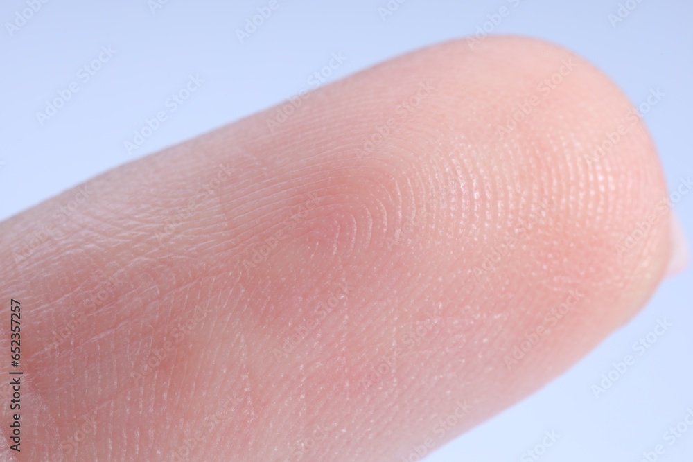 Finger with friction ridges on light blue background, macro view Finger with friction ridges on light blue background, macro view