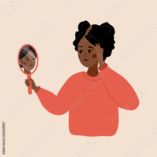 Baldness concept. Sad african woman loses her hair. Alopecia disease and problems of the scalp. Unhappy female character looking in mirror. Vector illustration in flat cartoon style.