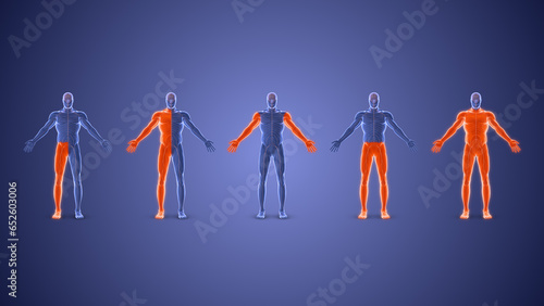 Obraz na plátně Different types of paralysis condition medical concept