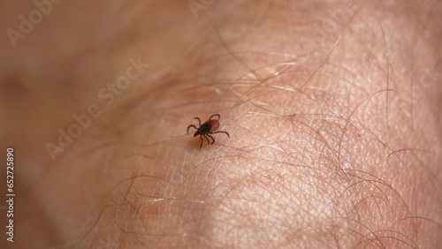 Tick Walking on Human Skin Seeking Place to Feed on Blood