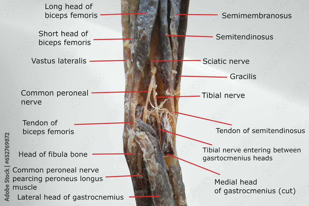 anatomy of popliteal region with the distal portion of back of thigh and proximal portion of back of leg. picture containing related muscles, nerves, tendon and fossa. - obrazy, fototapety, plakaty 