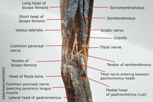 anatomy of popliteal region with the distal portion of back of thigh and proximal portion of back of leg. picture containing related muscles, nerves, tendon and fossa. photo