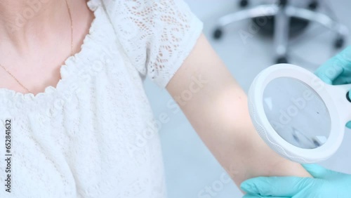 a female dermatologist using a medical magnifying glass in the clinic examines the patient's skin. photo
