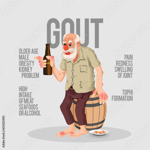 Old Person afflicted with Gout or Hyperuricemia sitting on a barrel of alcoholic beverage with some prawn for snacks. photo