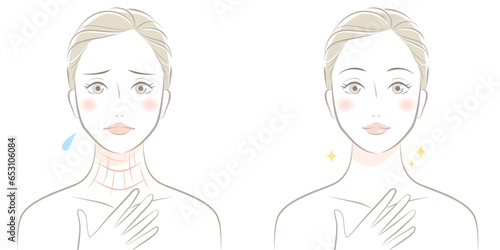 首のしわに悩む女性　ビフォーアフター