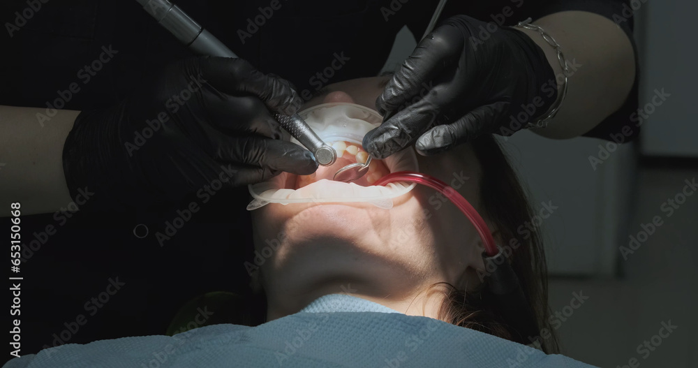 Dentist makes cleaning teeth with ultrasound. Removal tartar, process, patient lies in dentist's chair.