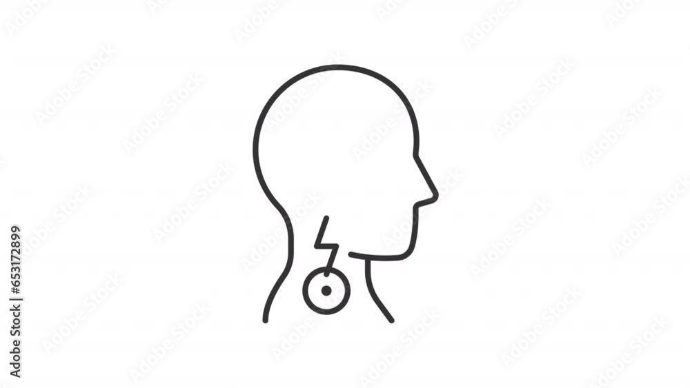2D black thin line animation of throat pain, HD video with transparent background, seamless loop 4K video representing medical treatment. 2D black thin line animation of throat pain, HD video with transparent background, seamless loop 4K video representing medical treatment.