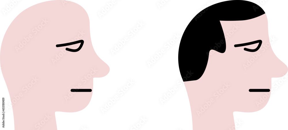 Bald Man with No Hair and Man with Black Hair Head Profile Icon Set. Vector Image.