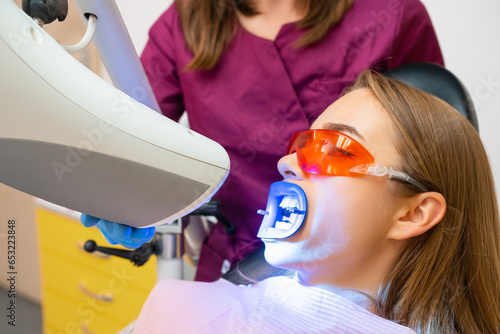 Tableau sur toile Teeth whitening for woman and application of UV lamp for bleaching teeth at dent
