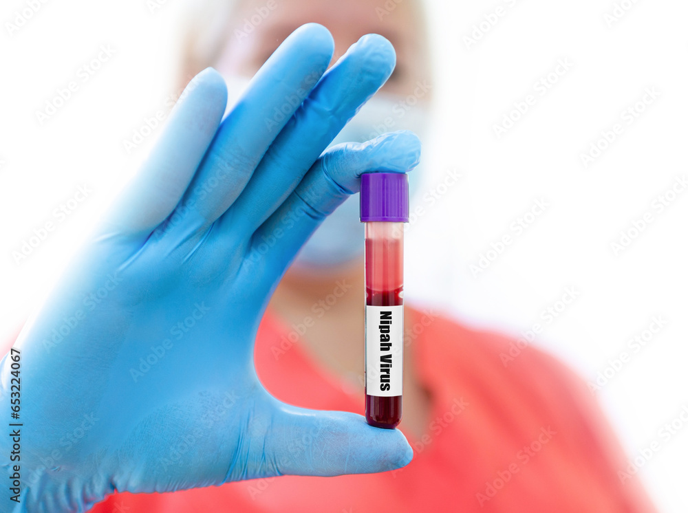 Nipah virus concept.Woman wearing a medical mask holding a glass test tube.Nipah Henipavirus is a newly emerging bat-borne virus that causes acute respiratory illness.Isolated white background. Nipah virus concept.Woman wearing a medical mask holding a glass test tube.Nipah Henipavirus is a newly emerging bat-borne virus that causes acute respiratory illness.Isolated white background.