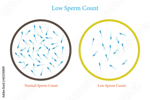 low sperm count. Male infertility oligospermia. Structure of the sperm. Vector. eps 10 photo