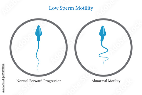 Sperm motility, low sperm count, Semen analysis, vector illustration eps10
