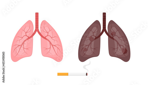 Healthy lungs and smokers lungs. Cigarette cancer concept. Pulmonary diseases.