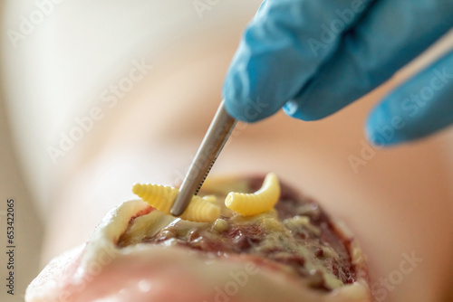 Obraz na płótnie Wound care concept: Symbolizing wound debridement with a fake wound and fake maggots, biological wound debridement as modern therapy w salonie