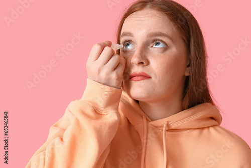 Allergic young woman with e...