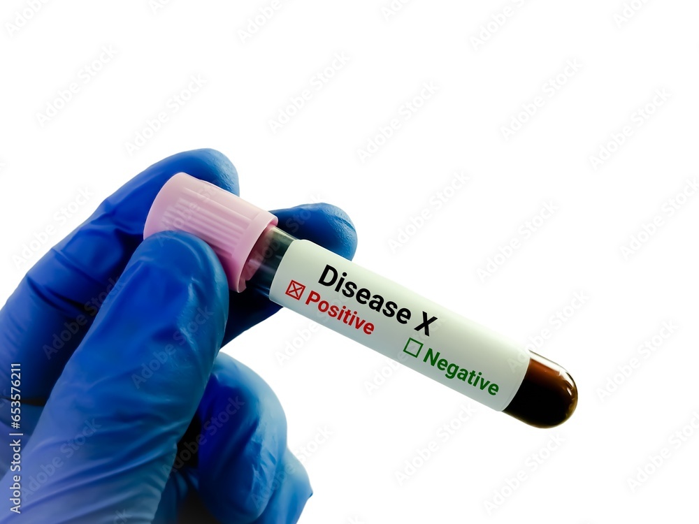 Obraz premium Blood sample for Disease X test. Disease X is the mysterious name given to the very serious threat that unknown viruses pose to human health