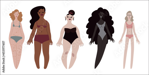 Five diverse women in swimsuits. Various body sizes and shapes. Diversity. Pale, tanned, dark and black skin tone and black, red, and blond hair. Vector illustration in flat style